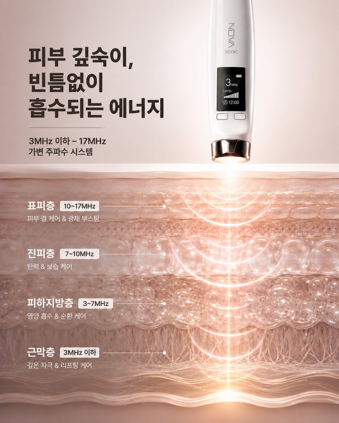 노바소닉 피부 층별 주파수 — 표피층 10~17MHz, 진피층 7~10MHz, 피하지방층 3~7MHz, 근막층 3MHz 이하